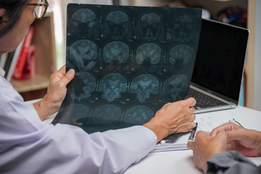 Doctor going over brain scan with senior for Alzheimer's